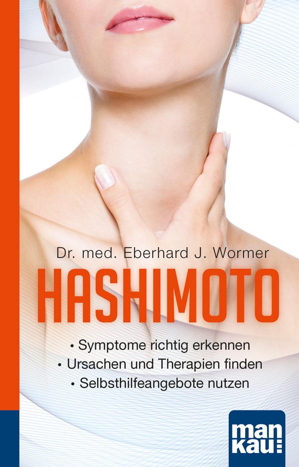 Big bigCover of Hashimoto. Kompakt-Ratgeber