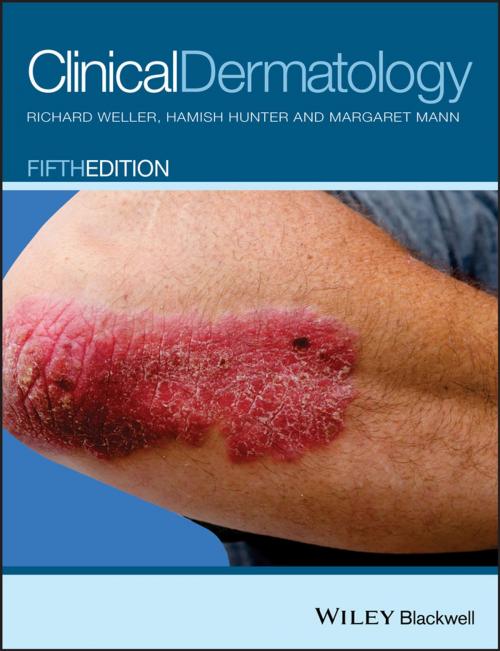 Cover of the book Clinical Dermatology by Margaret W. Mann, Richard B. Weller, Hamish J. A. Hunter, Wiley