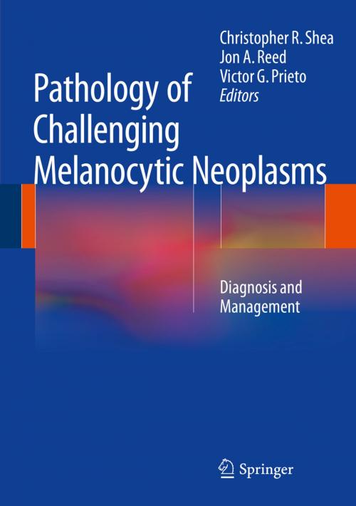 Cover of the book Pathology of Challenging Melanocytic Neoplasms by , Springer New York