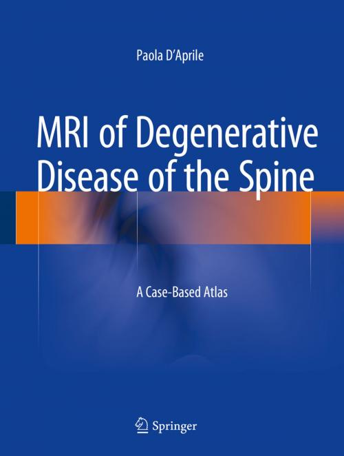 Cover of the book MRI of Degenerative Disease of the Spine by Paola D'Aprile, Springer International Publishing