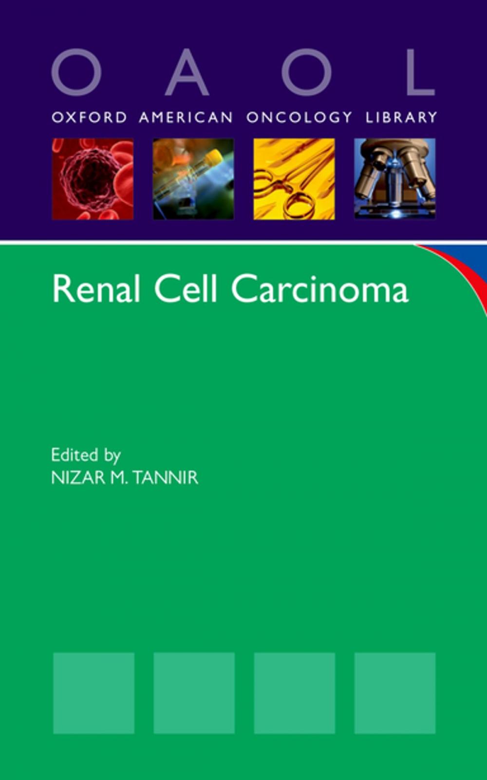 Big bigCover of Renal Cell Carcinoma