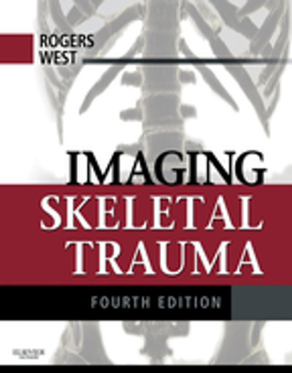 Big bigCover of Imaging Skeletal Trauma E-Book