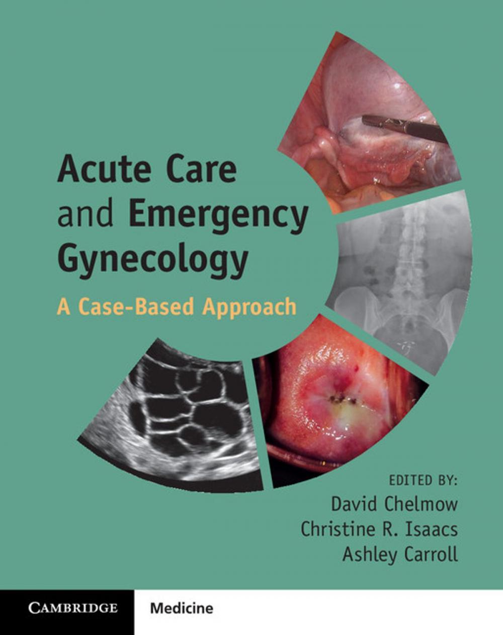 Big bigCover of Acute Care and Emergency Gynecology