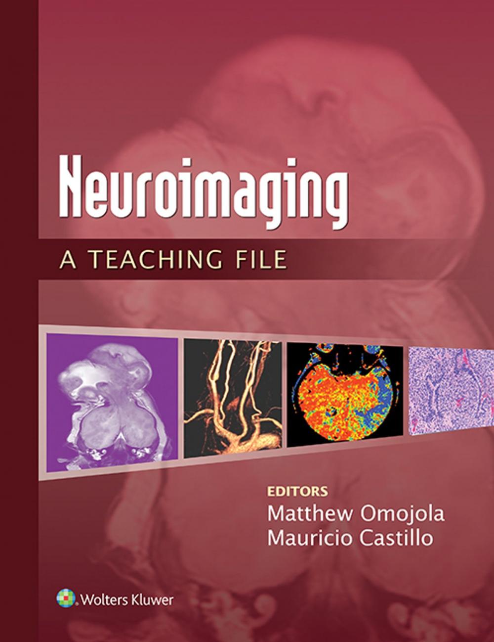 Big bigCover of Neuroimaging: A Teaching File