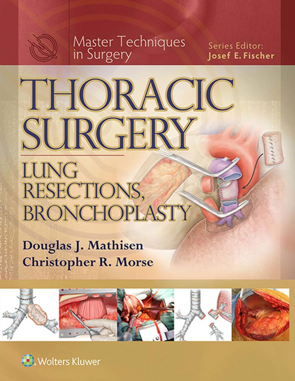 Big bigCover of Thoracic Surgery: Lung Resections, Bronchoplasty