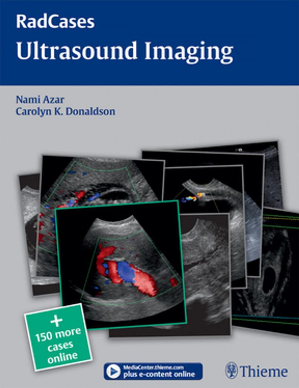 Big bigCover of Ultrasound Imaging