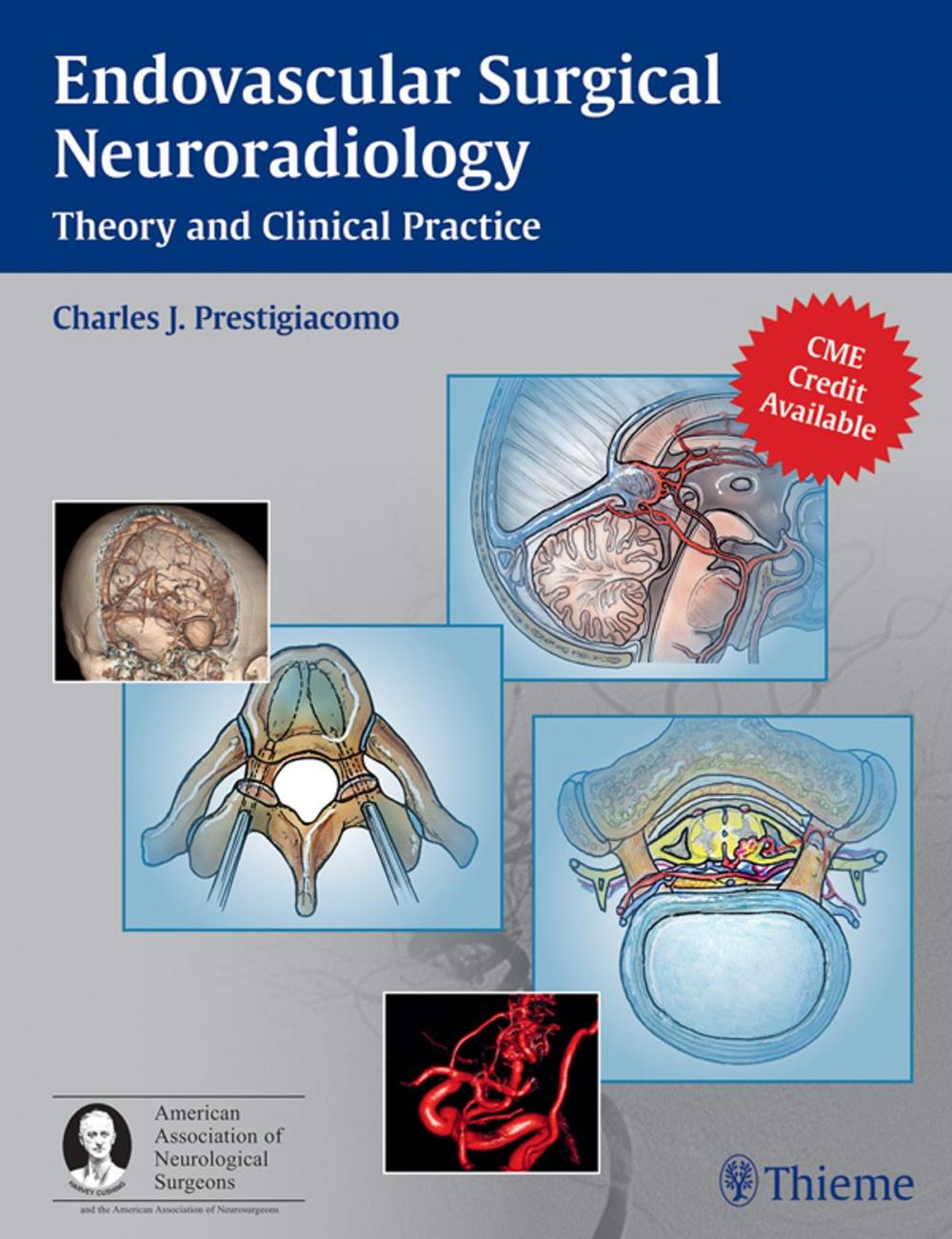 Big bigCover of Endovascular Surgical Neuroradiology