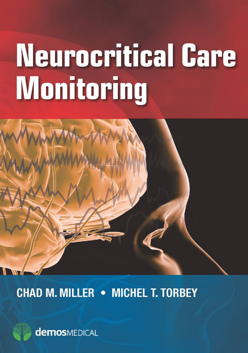 Big bigCover of Neurocritical Care Monitoring