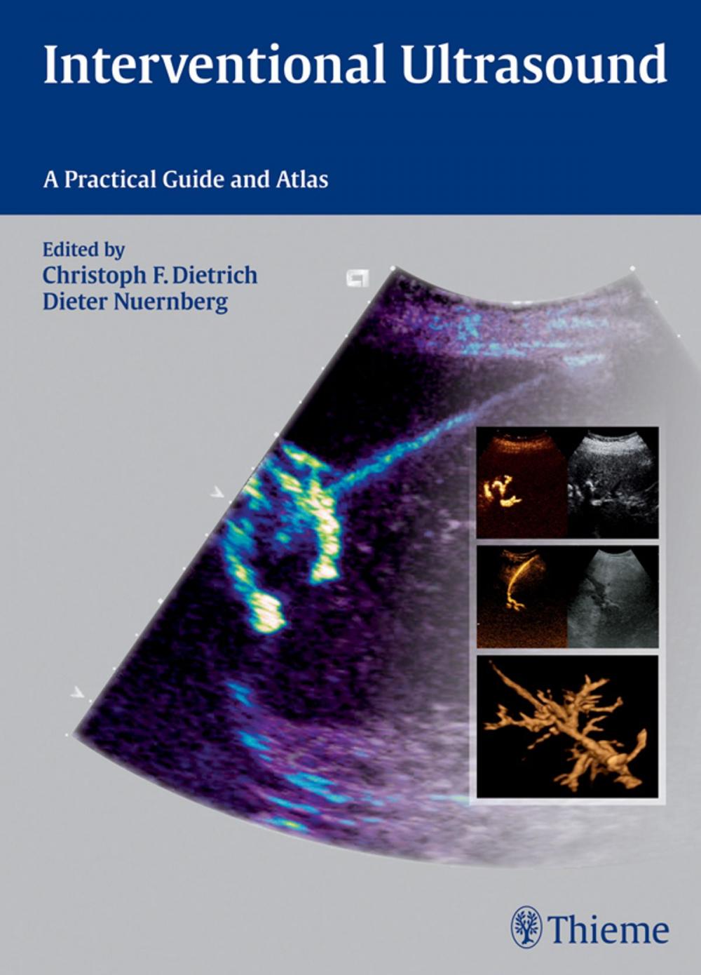 Big bigCover of Interventional Ultrasound