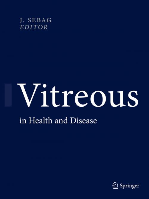 Cover of the book Vitreous by , Springer New York