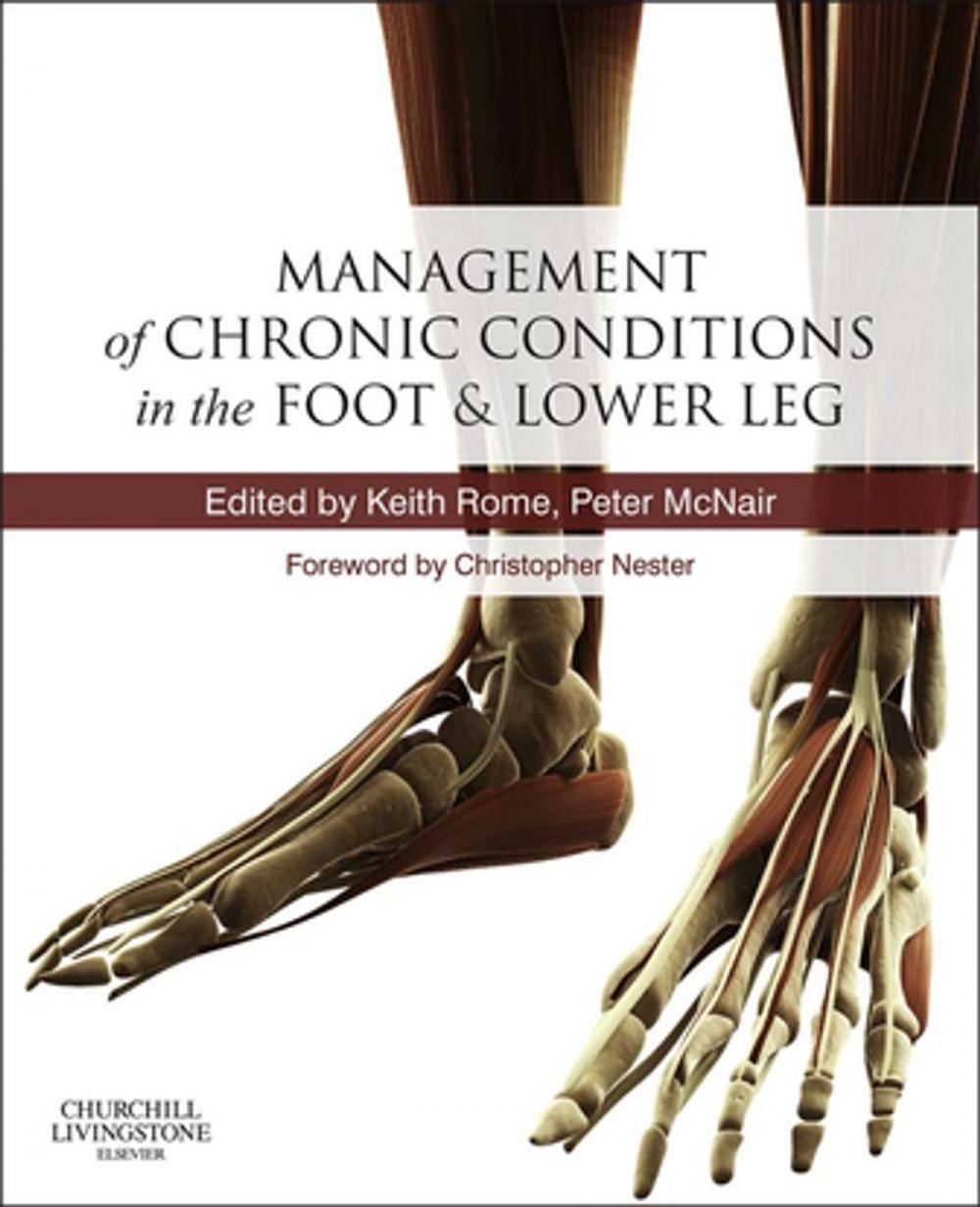 Big bigCover of Management of Chronic Musculoskeletal Conditions in the Foot and Lower Leg E-Book