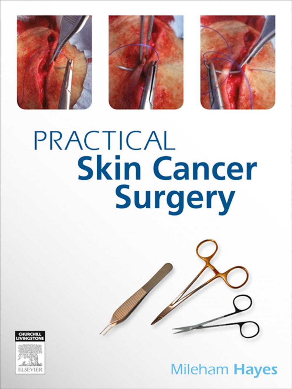 Big bigCover of Practical Skin Cancer Surgery