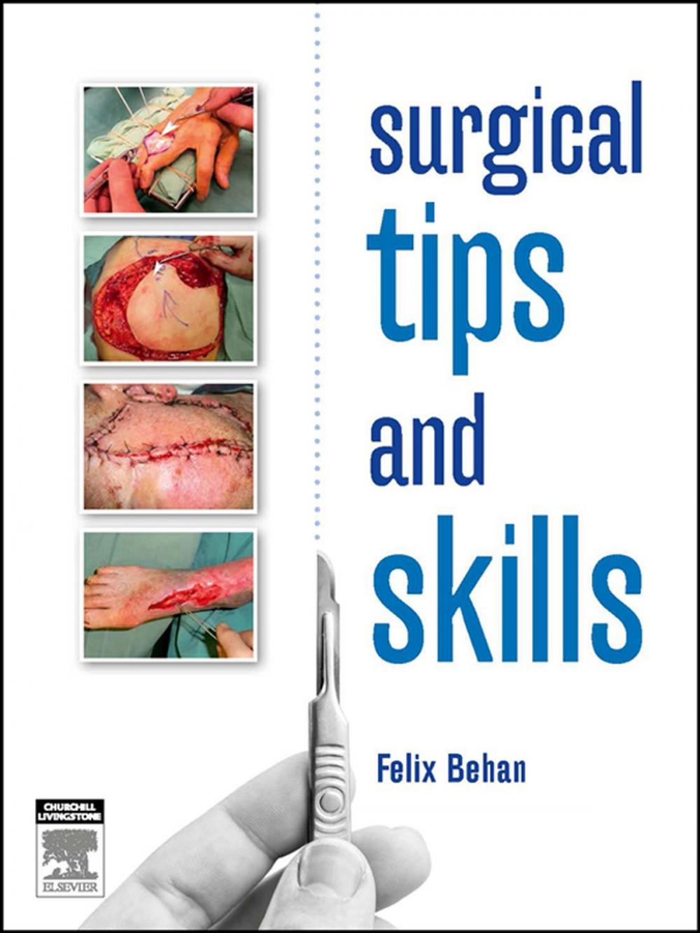 Big bigCover of Surgical tips and skills - eBook