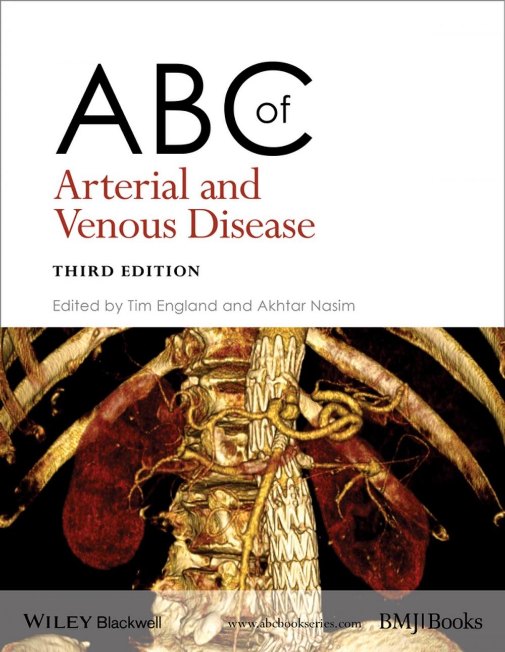 Big bigCover of ABC of Arterial and Venous Disease