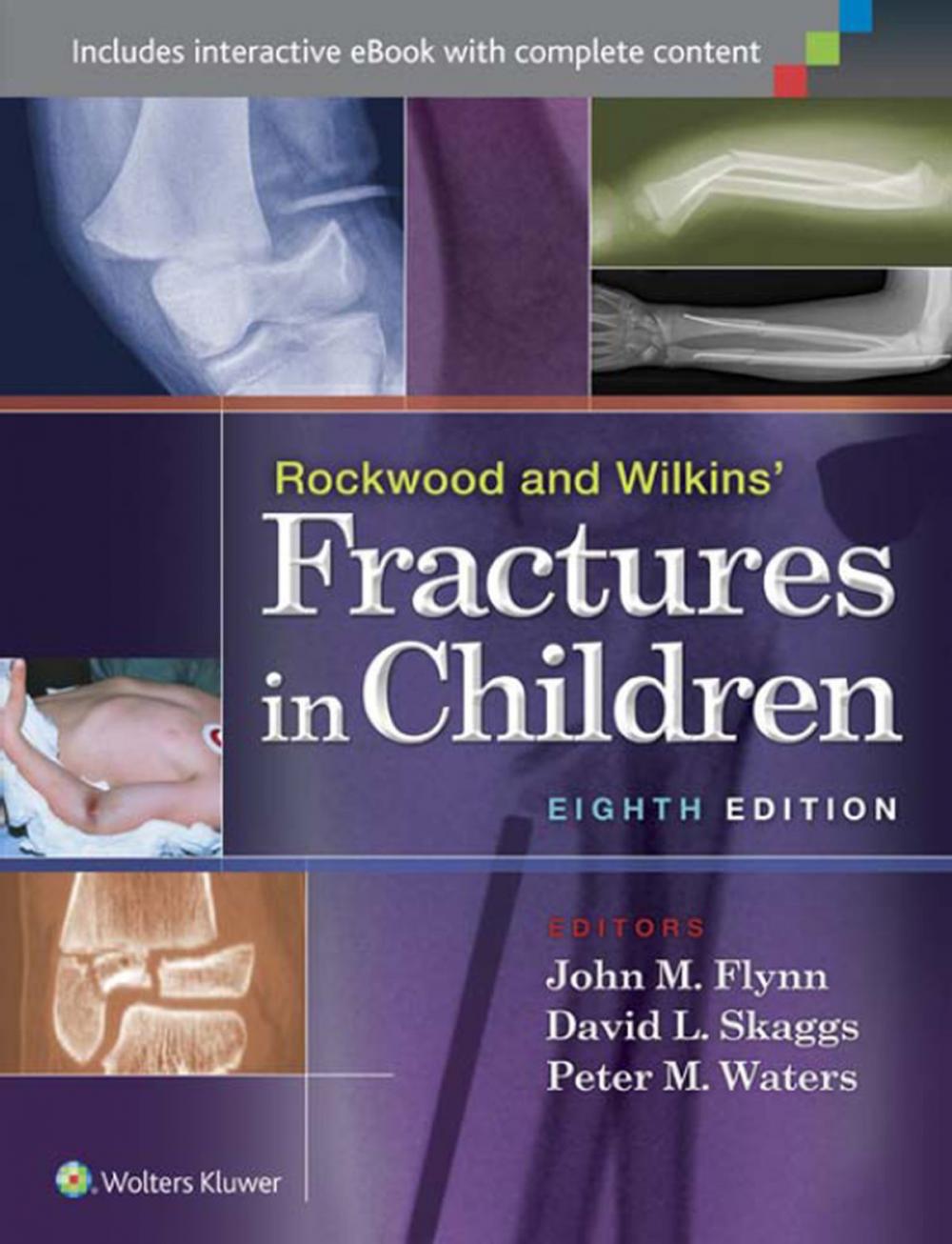 Big bigCover of Rockwood and Wilkins' Fractures in Children