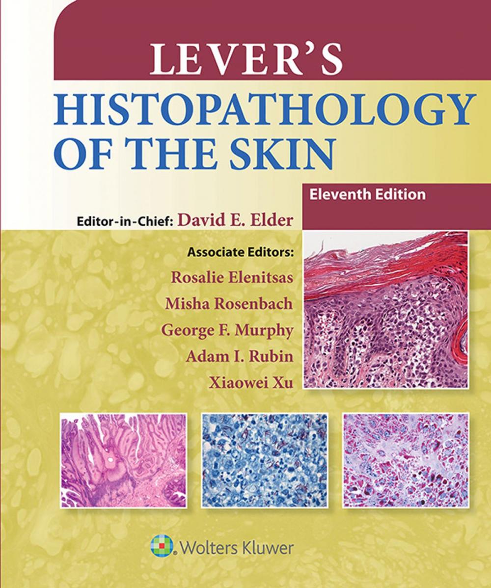 Big bigCover of Lever's Histopathology of the Skin
