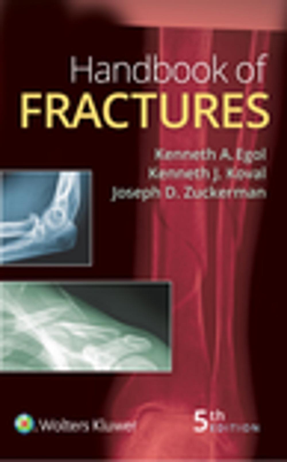 Big bigCover of Handbook of Fractures