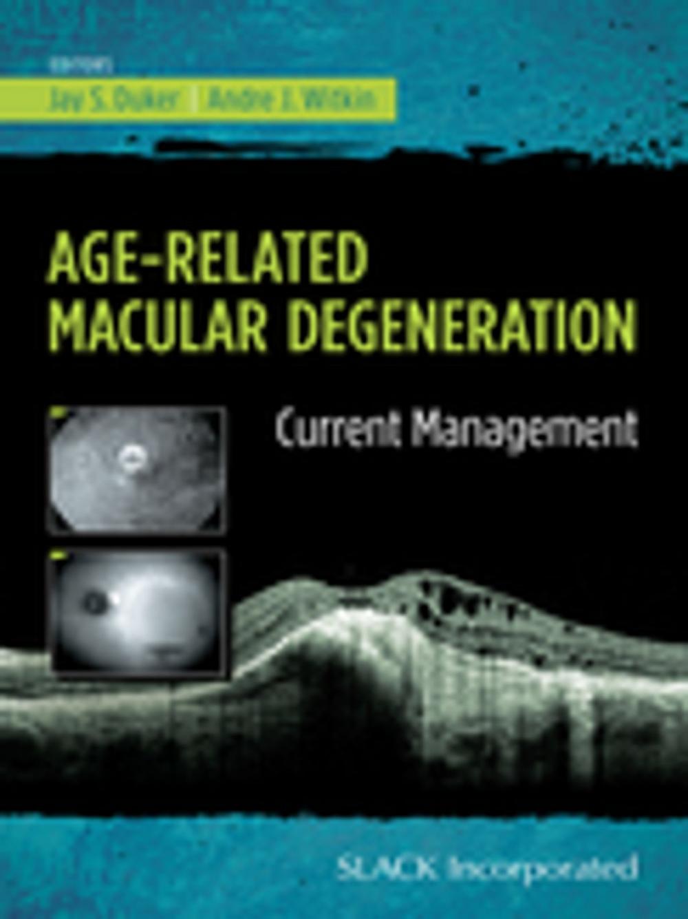 Big bigCover of Age-Related Macular Degeneration