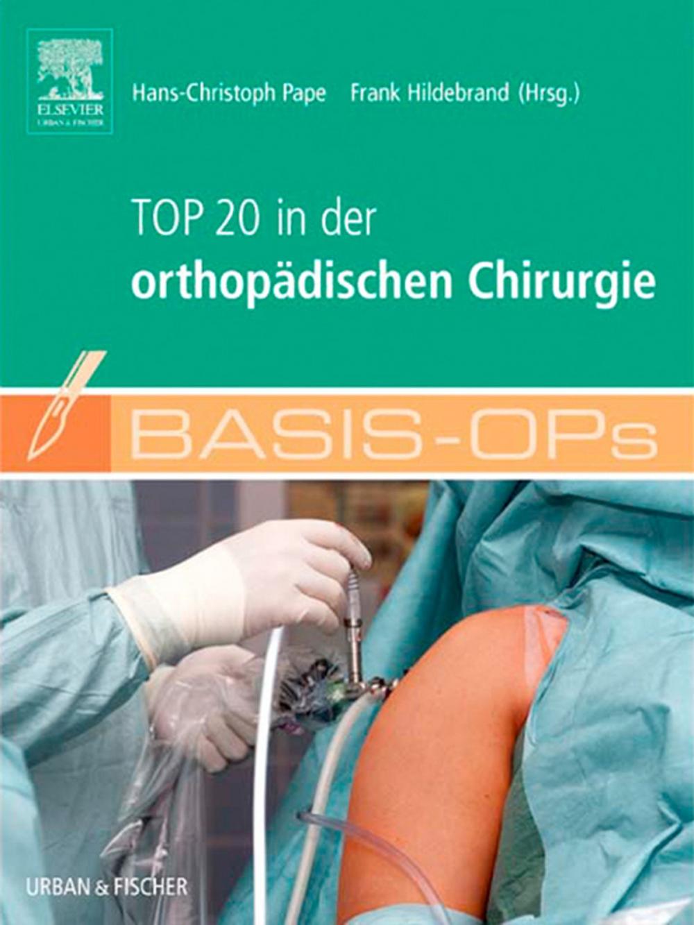 Big bigCover of Basis OPs - Top 20 in der orthopädischen Chirurgie