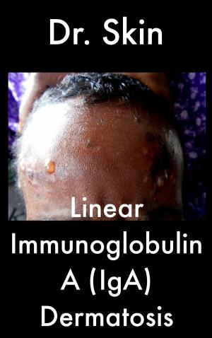 Book cover of Linear Immunoglobulin A Dermatosis
