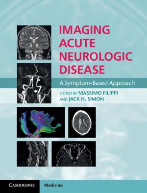 Cover of the book Imaging Acute Neurologic Disease by Melanie J. Hatcher, Alison M. Dunn