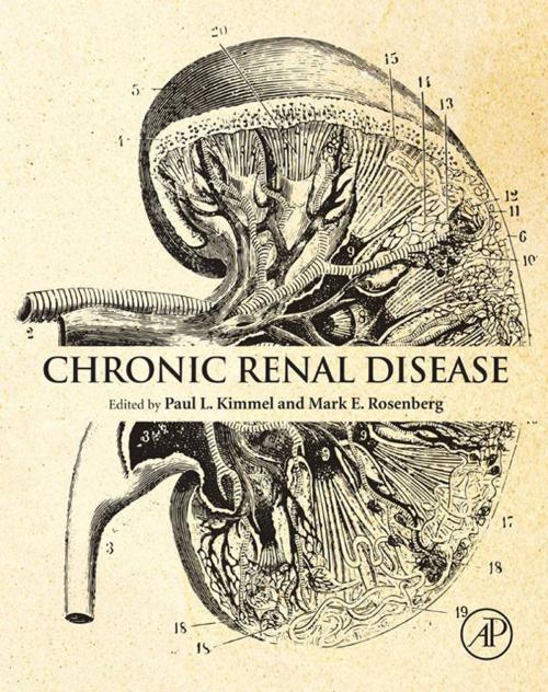 Cover of the book Chronic Renal Disease by , Elsevier Science