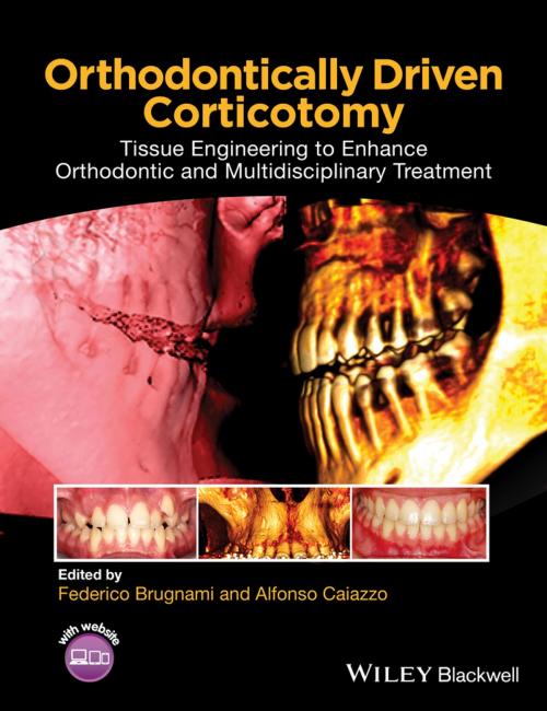 Cover of the book Orthodontically Driven Corticotomy by , Wiley