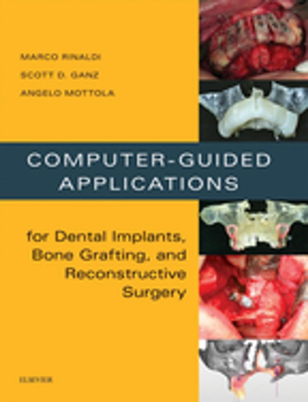 Big bigCover of Computer-Guided Dental Implants and Reconstructive Surgery - E-Book