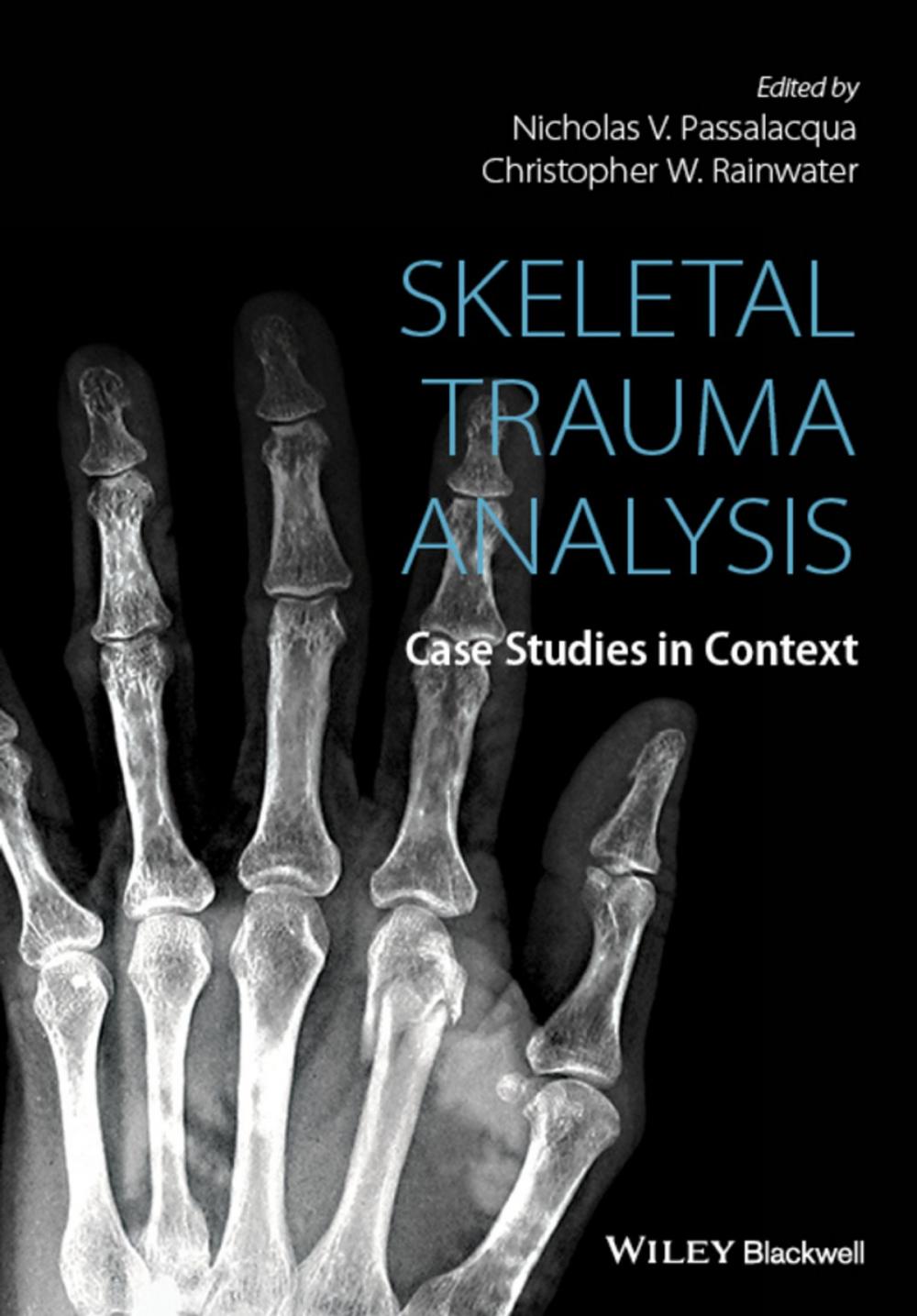 Big bigCover of Skeletal Trauma Analysis