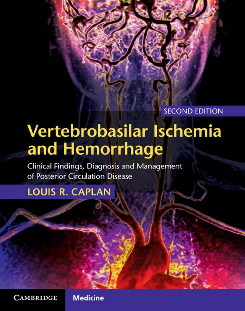 Big bigCover of Vertebrobasilar Ischemia and Hemorrhage