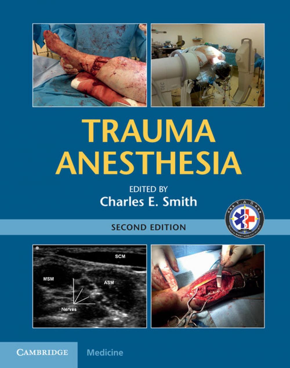 Big bigCover of Trauma Anesthesia