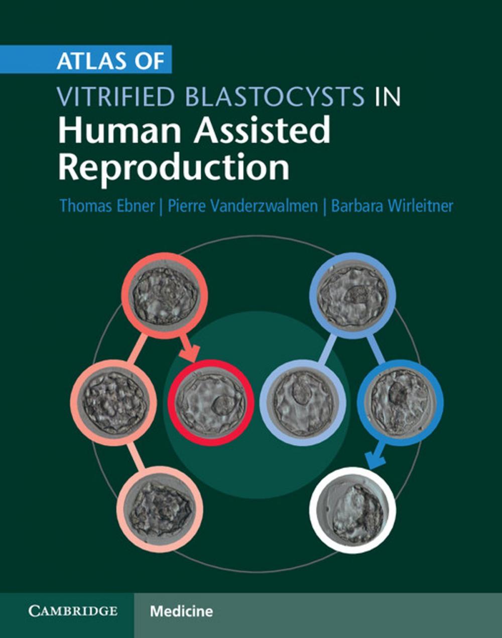 Big bigCover of Atlas of Vitrified Blastocysts in Human Assisted Reproduction