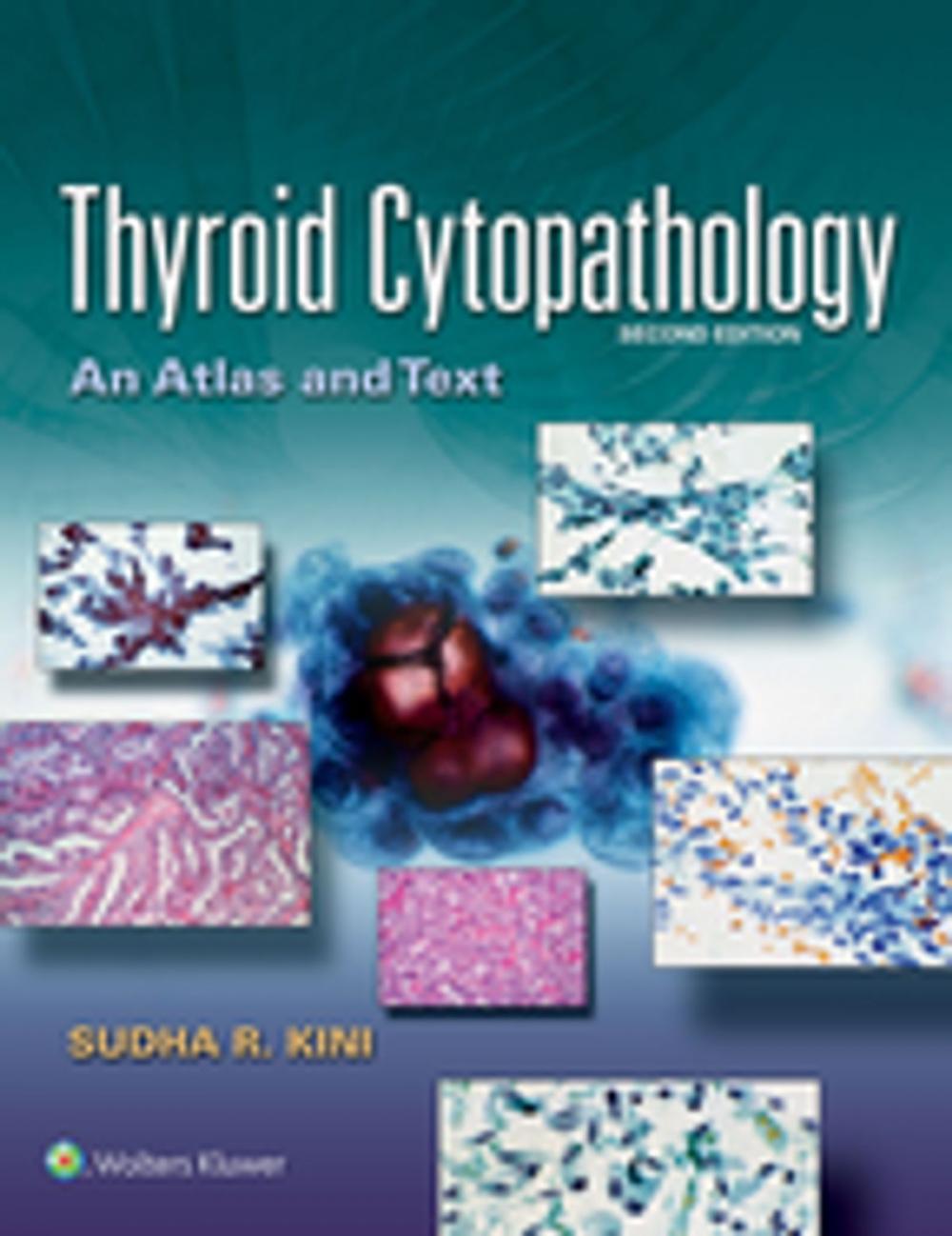 Big bigCover of Thyroid Cytopathology