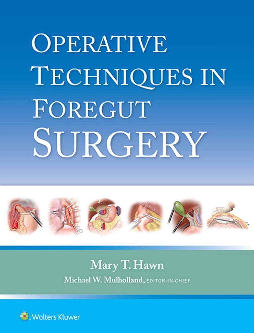 Big bigCover of Operative Techniques in Foregut Surgery