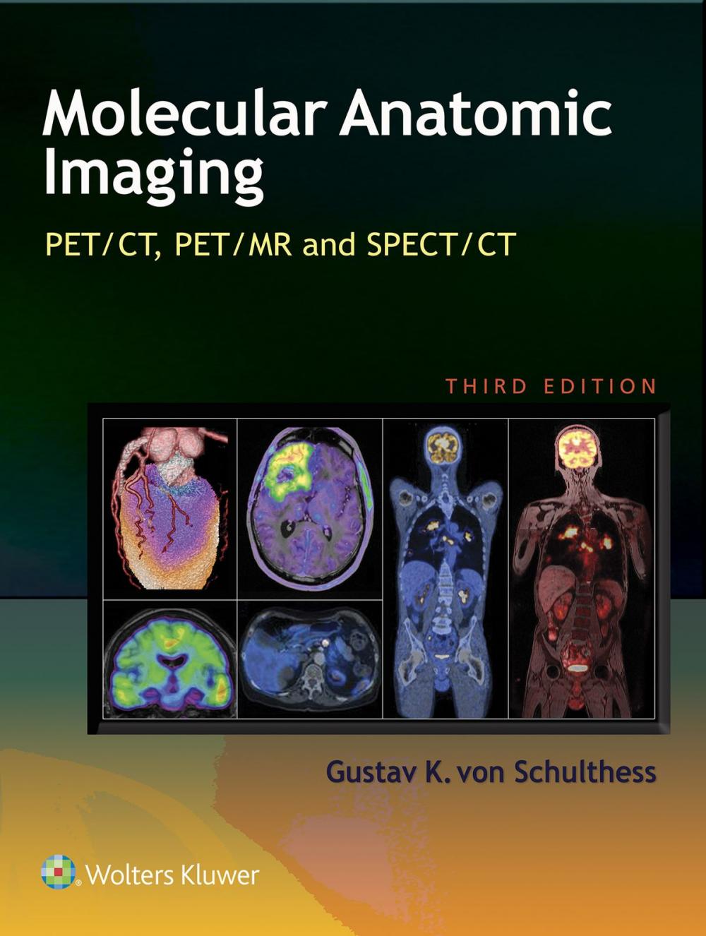 Big bigCover of Molecular Anatomic Imaging