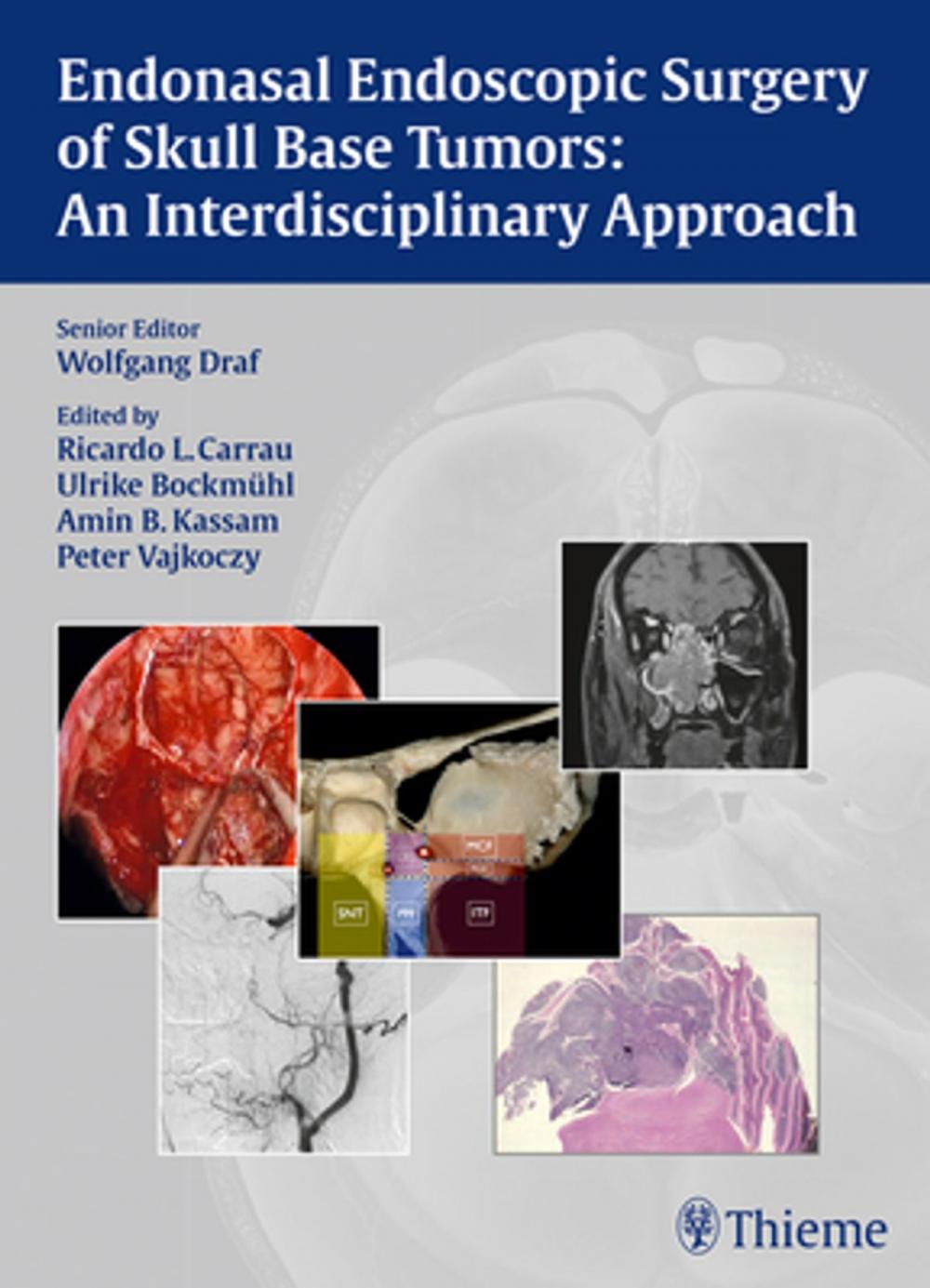 Big bigCover of Endonasal Endoscopic Surgery of Skull Base Tumors