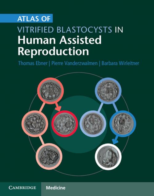 Cover of the book Atlas of Vitrified Blastocysts in Human Assisted Reproduction by Thomas Ebner, Pierre Vanderzwalmen, Barbara Wirleitner, Cambridge University Press