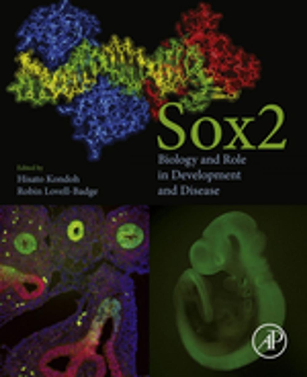 Big bigCover of Sox2