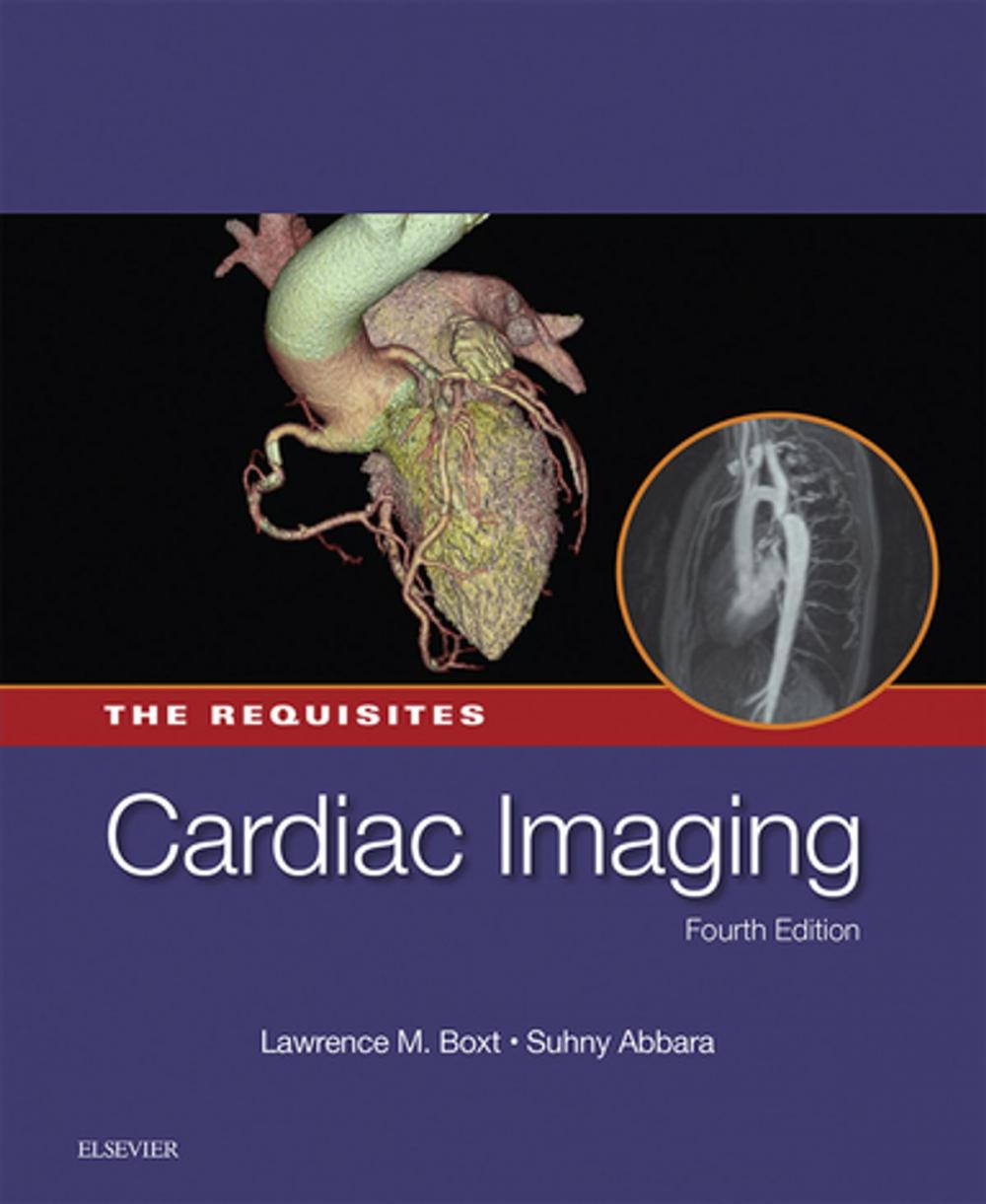 Big bigCover of Cardiac Imaging: The Requisites E-Book