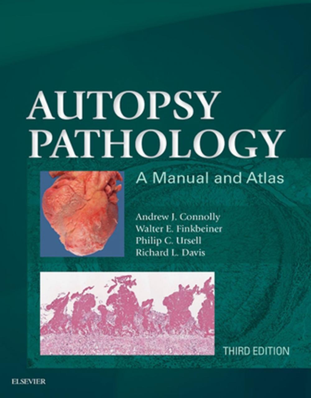 Big bigCover of Autopsy Pathology: A Manual and Atlas E-Book