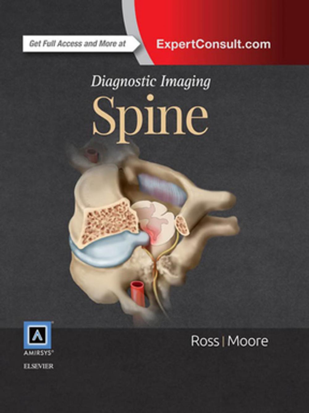 Big bigCover of Diagnostic Imaging: Spine E-Book