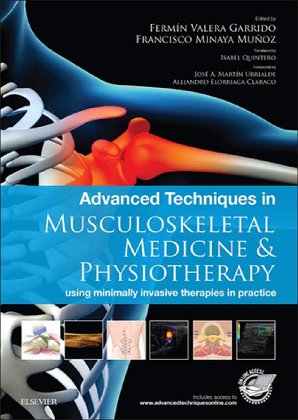 Big bigCover of Advanced Techniques in Musculoskeletal Medicine & Physiotherapy - E-Book