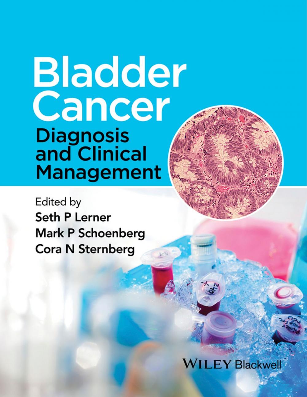 Big bigCover of Bladder Cancer