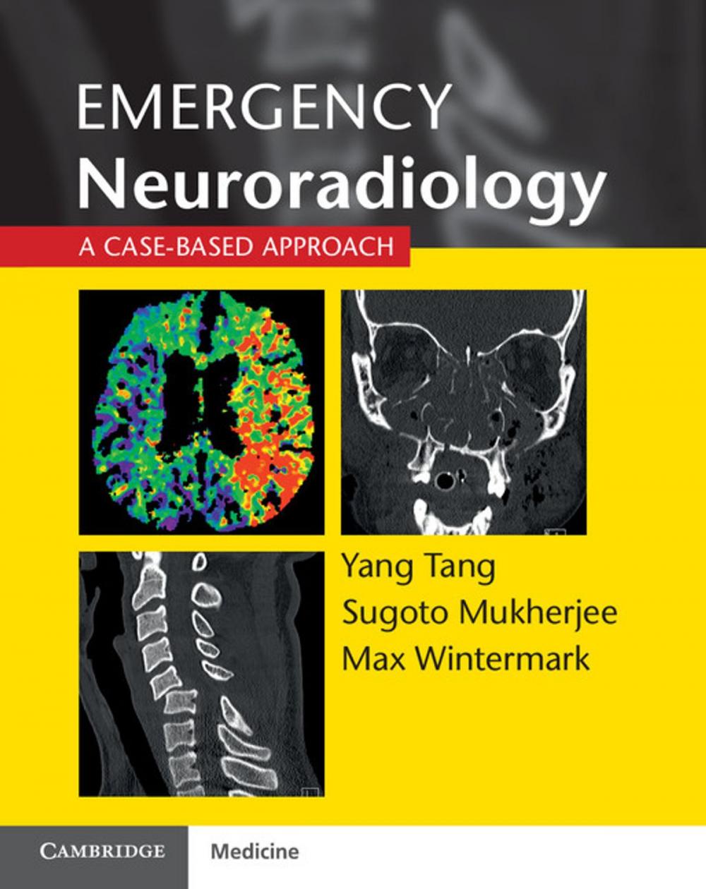 Big bigCover of Emergency Neuroradiology