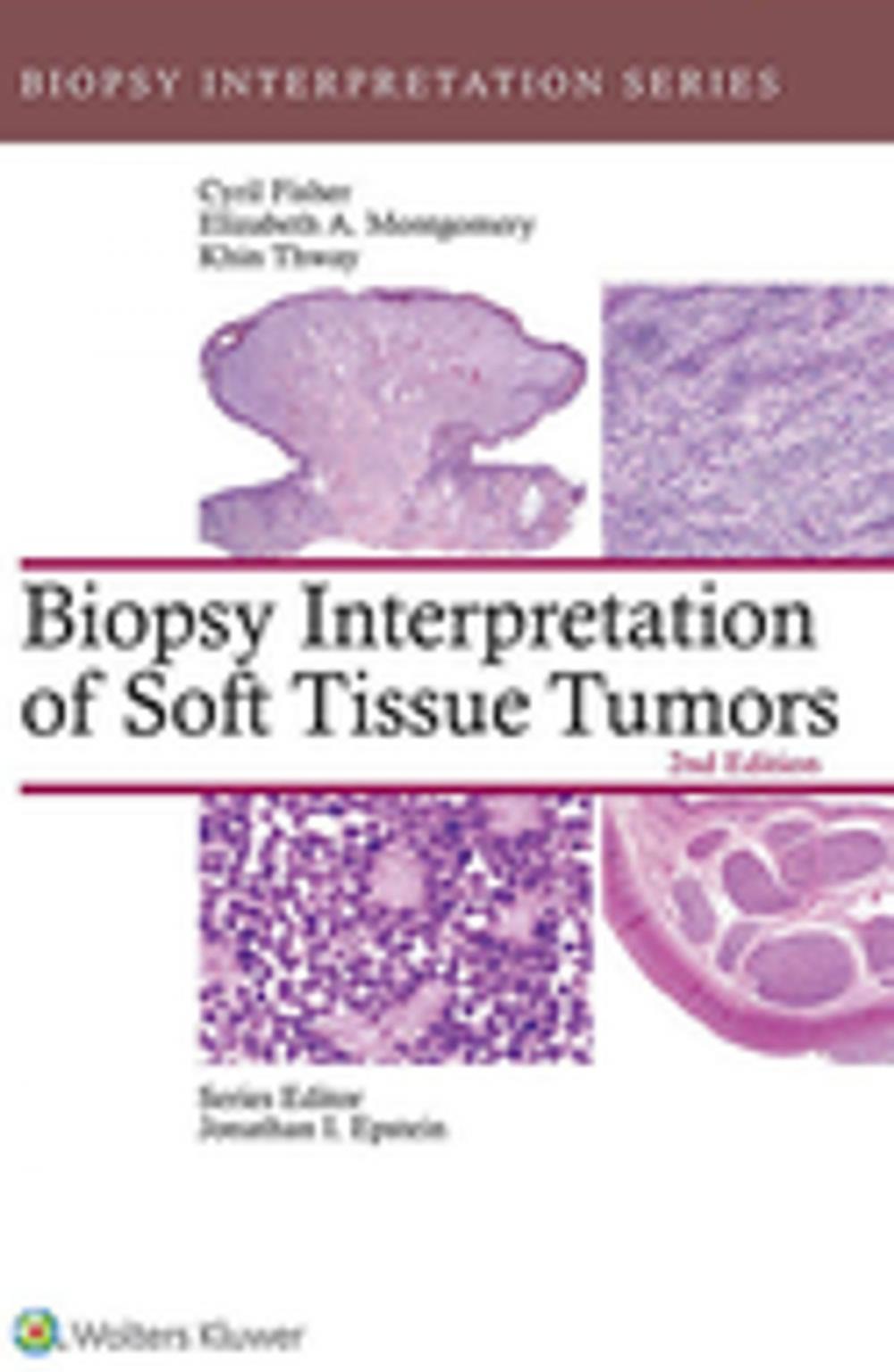 Big bigCover of Biopsy Interpretation of Soft Tissue Tumors