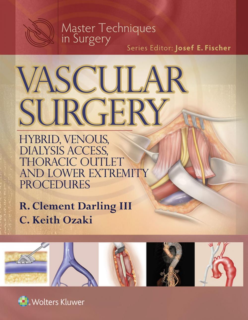 Big bigCover of Master Techniques in Surgery: Vascular Surgery: Hybrid, Venous, Dialysis Access, Thoracic Outlet, and Lower Extremity Procedures