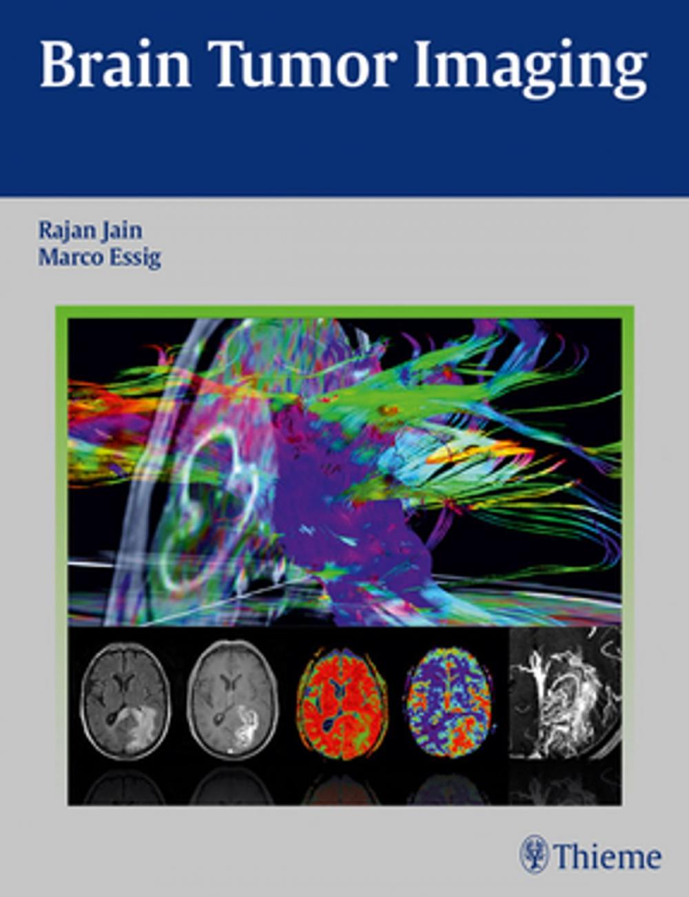 Big bigCover of Brain Tumor Imaging