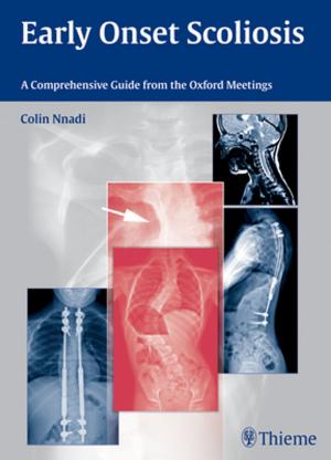 Cover of the book Early Onset Scoliosis by Todd J. Albert, Alexander R. Vaccaro