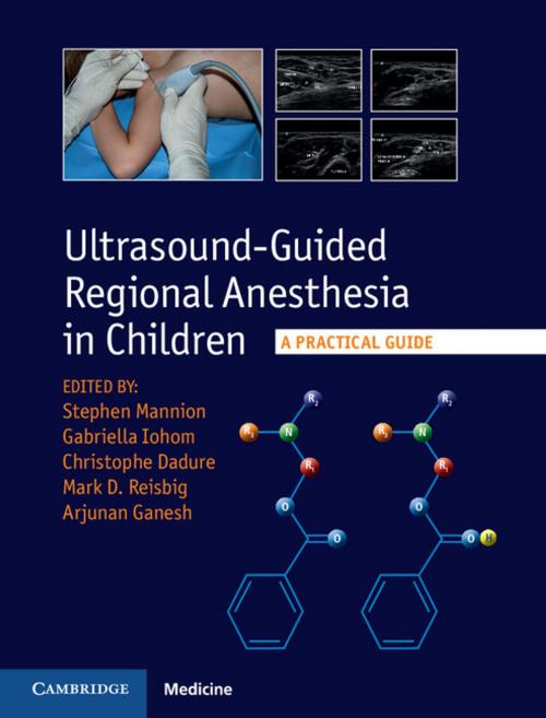 Cover of the book Ultrasound-Guided Regional Anesthesia in Children by , Cambridge University Press