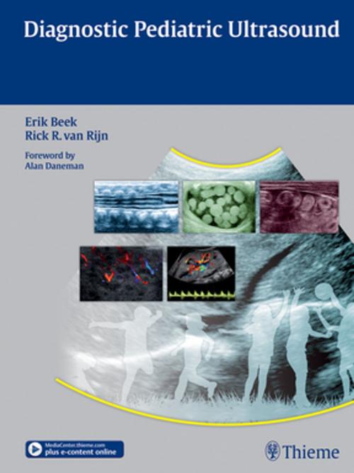 Cover of the book Diagnostic Pediatric Ultrasound by Erik Beek, Rick van Rijn, Thieme